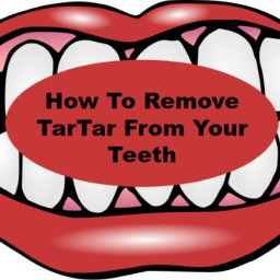 How To Remove TarTar From Your Teeth